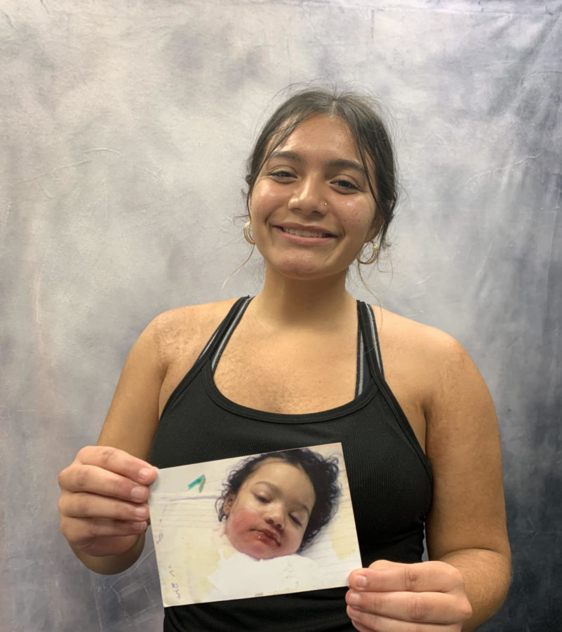 A now seventeen-year-old Garcia poses with a photo of 
her younger self in recovery after the accident. Garcia’s 
scars cover her arm and shoulders in the photo. 